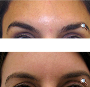 Before/After